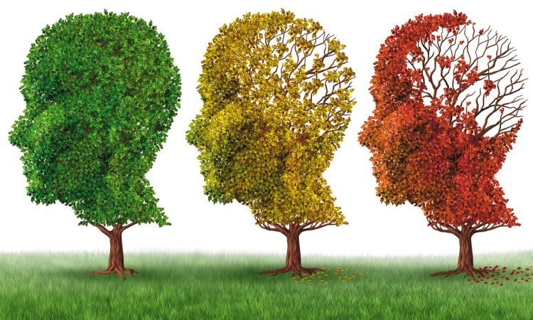 Dicas de Segurança Para Cuidar de Alzheimer em Casa